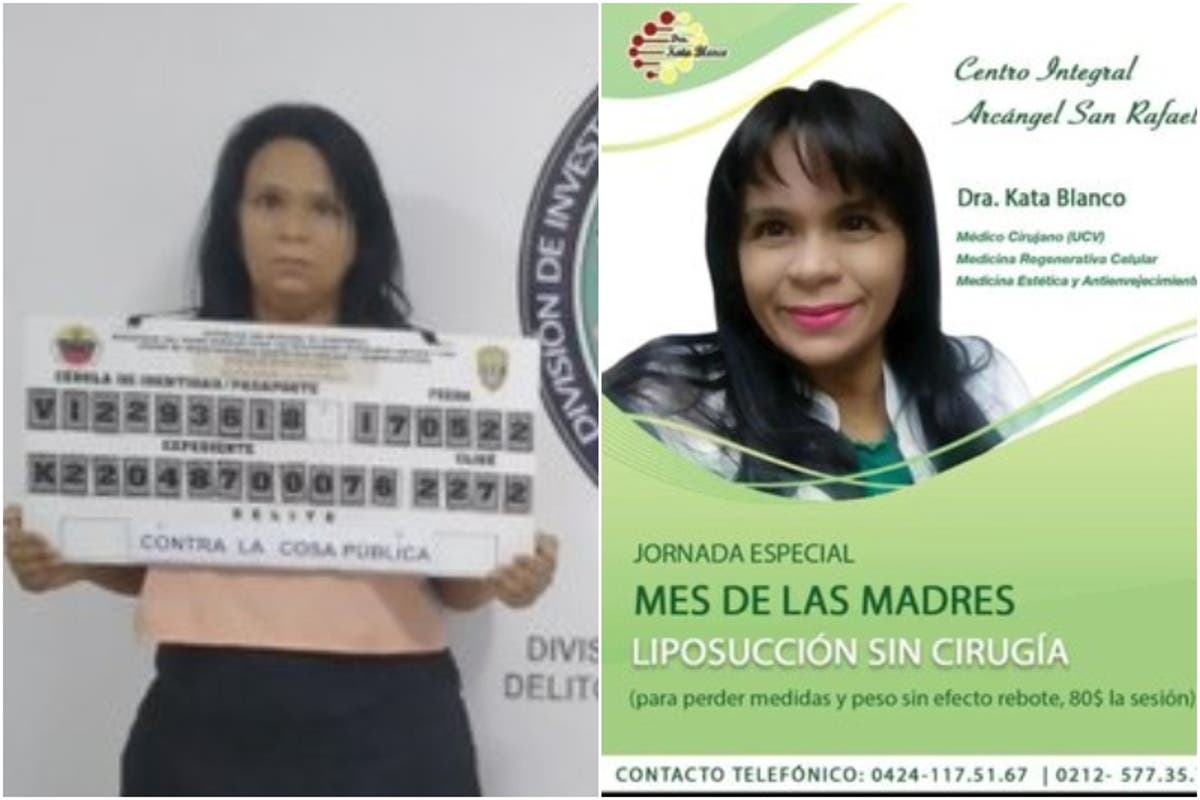 Detenida falsa cirujana en La Candelaria que ofrecía tratamientos estéticos