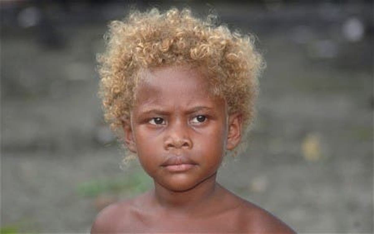 Dark Skin And Natural Blond Hair Genetic Mystery Solved