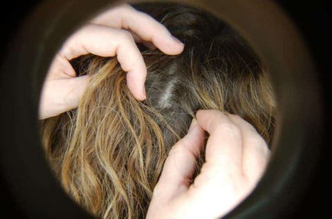 Mutated Lice Stop Responding To Common Treatment