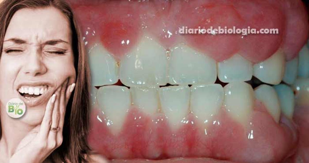 gengiva inchada e doendo remedio caseiro