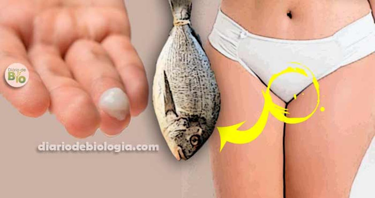 corrimento amarelo antes da menstruação é normal corrimento amarelo antes da menstruação é normal