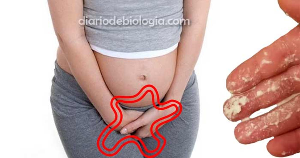 Corrimento Na Gravidez E Normal Quando Preciso Me Preocupar Diario De Biologia O aumento do corrimento vaginal na gravidez é muito comum e, na maioria dos casos, desde que não haja certos sintomas associados, não há motivo para preocupação. corrimento na gravidez e normal quando