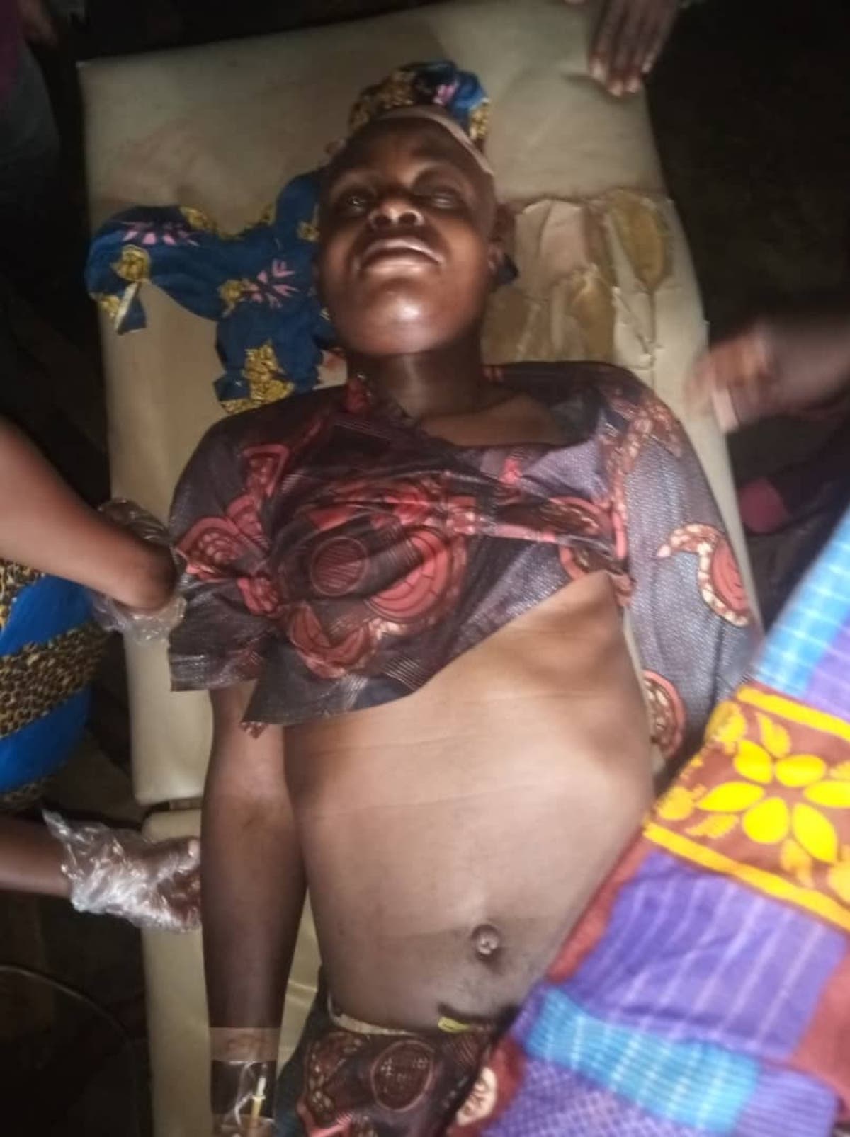 Man goes into coma after hit by Customs' stray bullet in Ogun