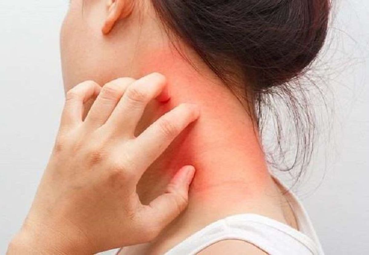 Ciencia Y Salud Que Debo De Hacer Si Tengo La Piel Irritada