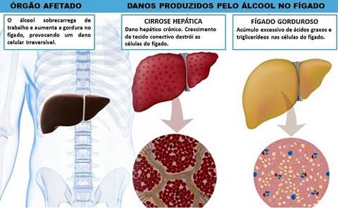 Álcool muito varizes beber pode causar