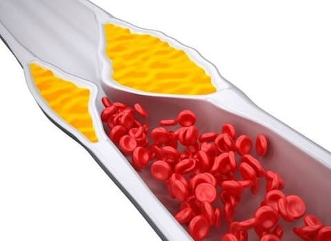 A saúde para alimentos comer veias para das