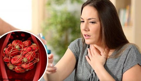 De pernas nas imagens coágulo de sangue
