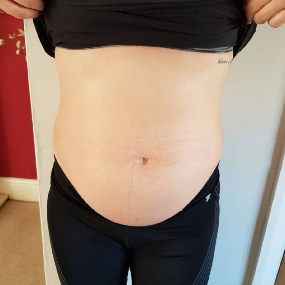Woman Has Huge Ovarian Cyst Removed After Gym Instructor Asked If She S Pregnant Real Fix Magazine