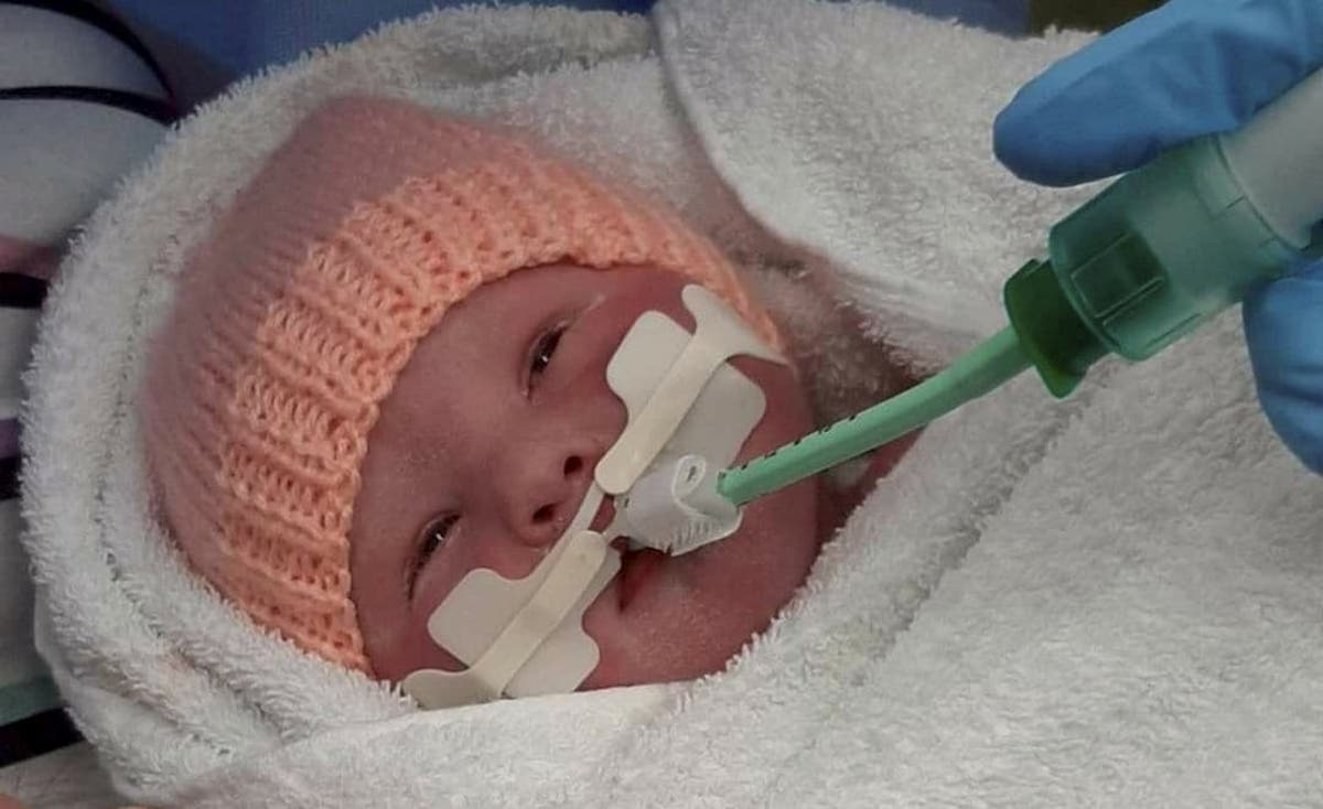 Miracle Baby Born With A Hole In Her Throat Finally Able To Go Home After Spending The First Five Months Of Her Life In Hospital Real Fix Magazine Miracle Baby Born With A Hole In Her Throat Finally Able To Go Home After Spending The First Five Months Of Her Life In Hospital Real Fix Magazine